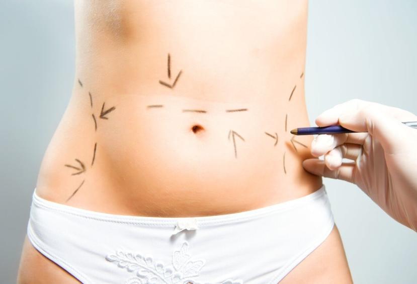 Is Binge Eating Disorder Hereditary?