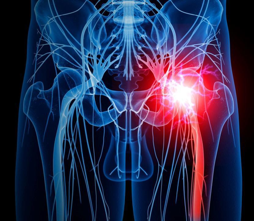 Sciatic Nerve Pain and the BPR Method™