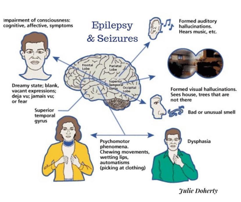 Complementary & Self Help for Epilepsy and Seizures!