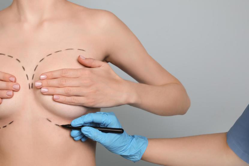 Breast Augmentation Basics
