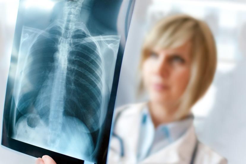 Atelectasis vs Pneumothorax: What’s the Difference?