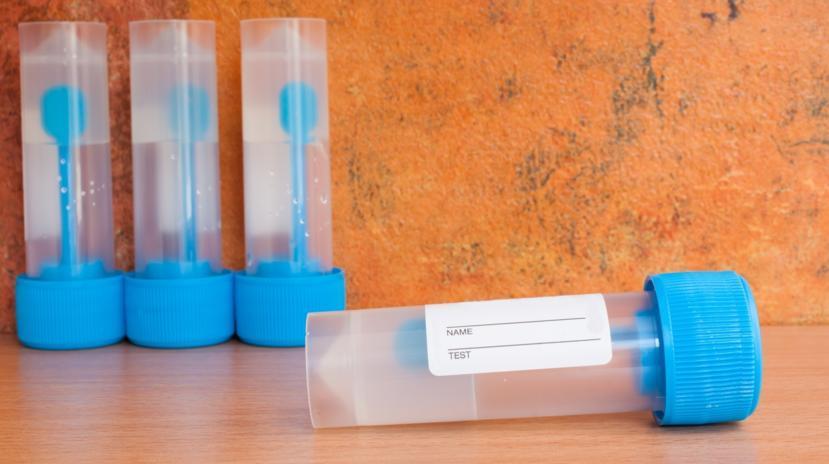 Blood in Your Stool: When to Visit a Doctor