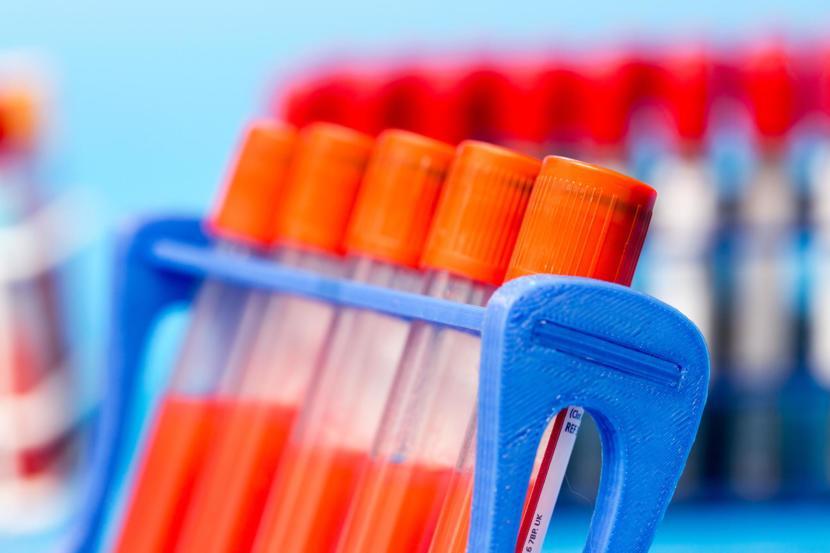 This Blood Test Can Monitor Multiple Sclerosis Treatment Progress
