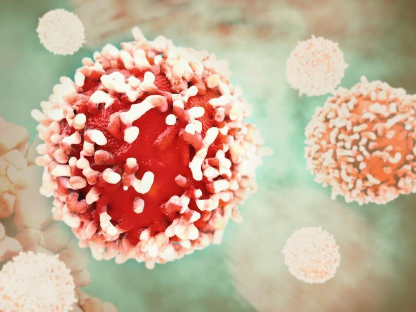 Cancer in the Lymph Nodes