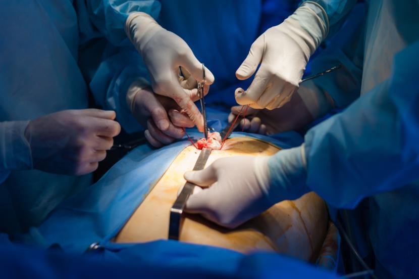 Everything You Need to Know About a Cholecystectomy