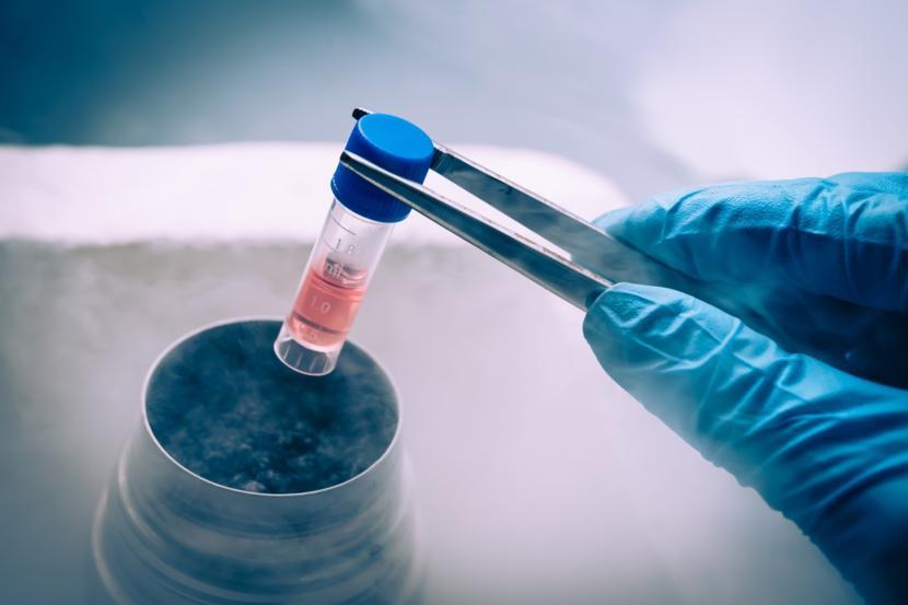 Stem Cell Infusion as Possible Crohn's Fistula Therapy