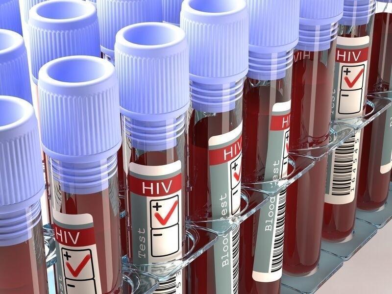 Is There a Window Period to Test for HIV?