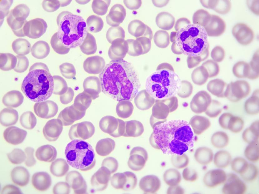 What Are Leukocytes? Types of Leukocytes