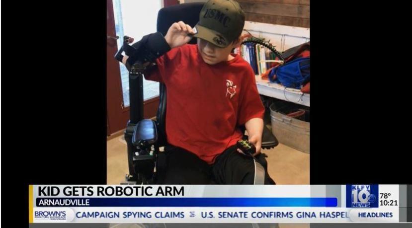 Robotic Arm Gives Teen with Muscular Dystrophy A New Lease on Life