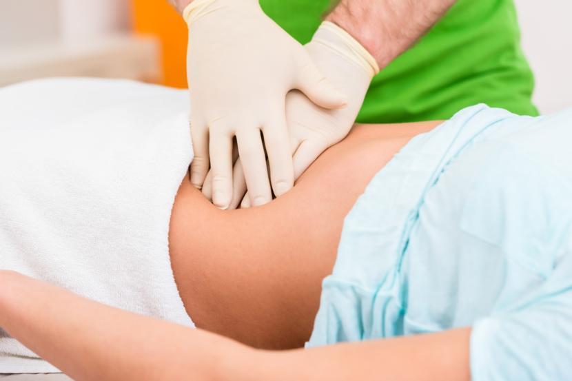 The Use of Surgery for Ulcerative Colitis