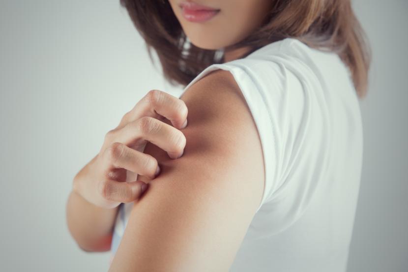 What Causes Heat Rash?