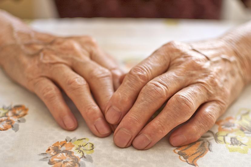 What is Rheumatoid Arthritis?