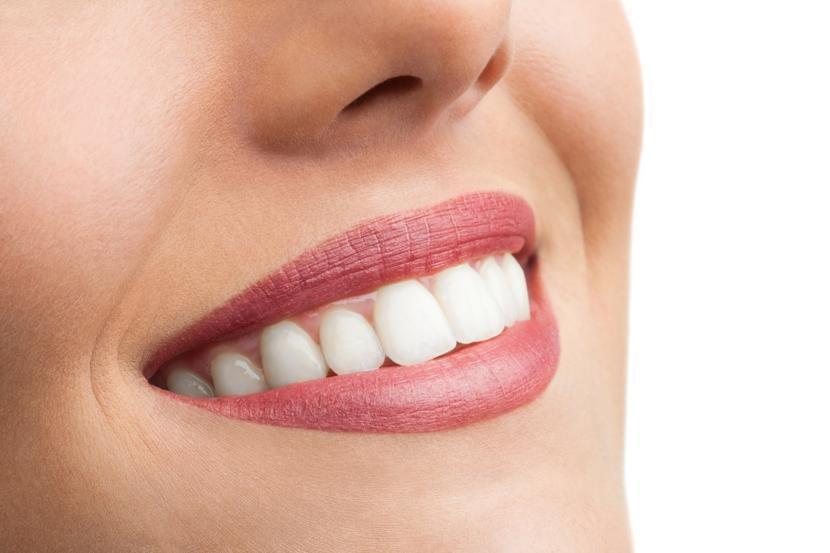 How Zoom Teeth Whitening Can Change Your Life