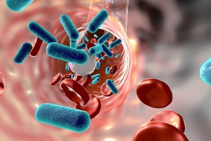 What are the Signs and Symptoms of Sepsis?