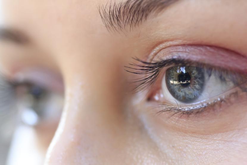 How to Avoid Dark Circles Under Your Eyes