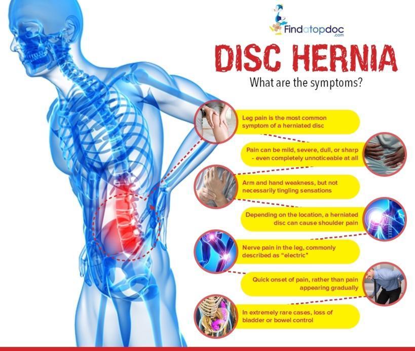 Disc Hernia