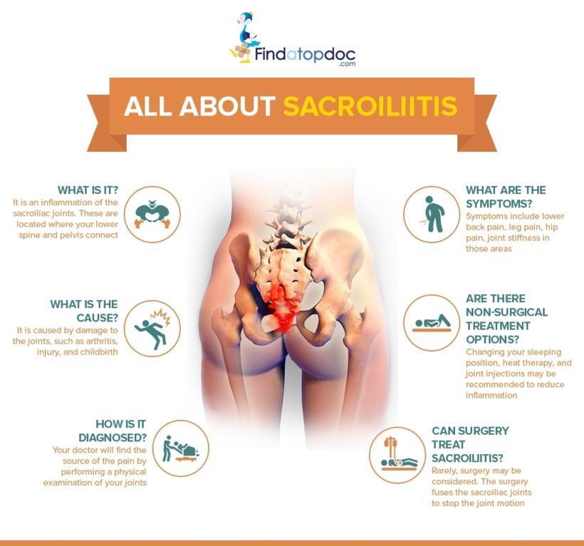 Sacroiliitis