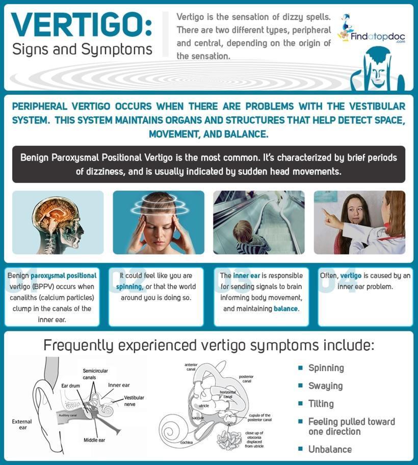 Vertigo