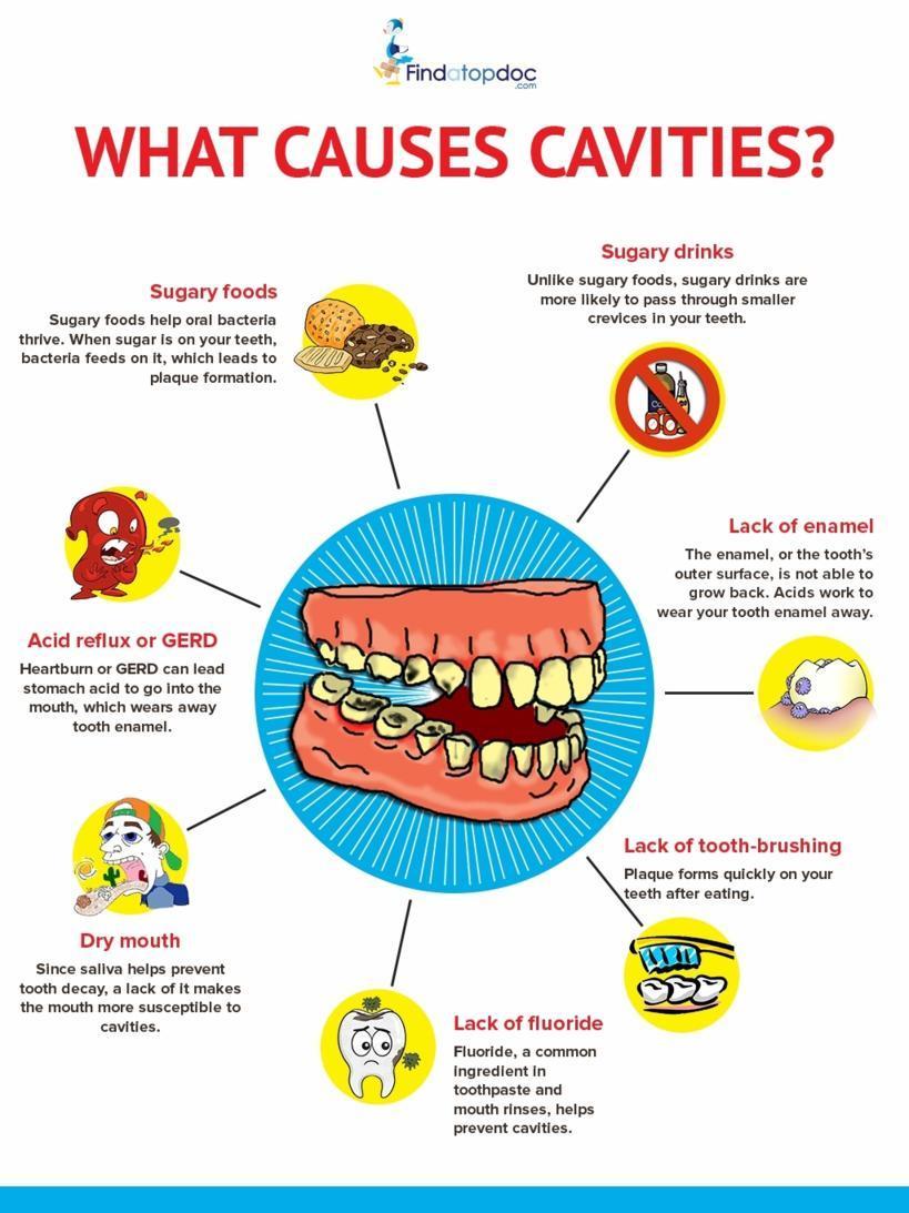 What Causes Cavities?