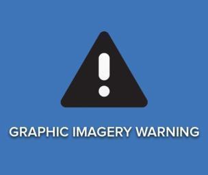 Warning: possible graphic imagery