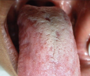 Intestinal Problems